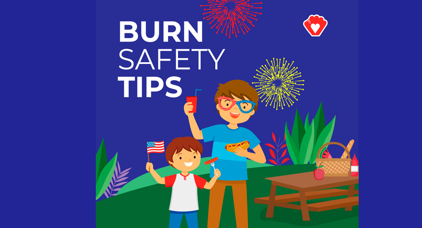 burn safety tips blog