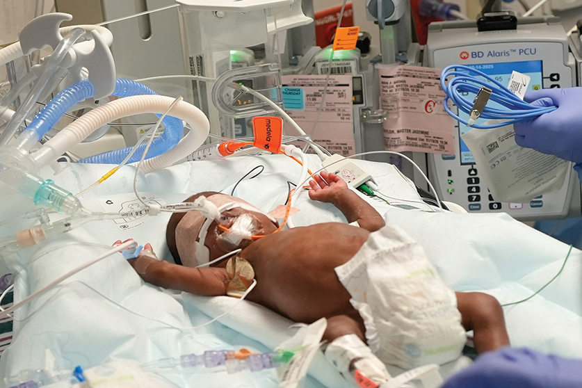 newborn post congenital heart surgery