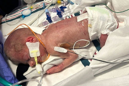 Casey as a newborn in the NICU